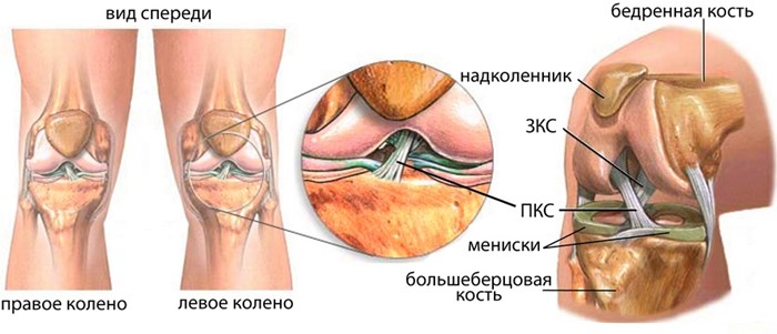 Лигаментит связок коленного сустава