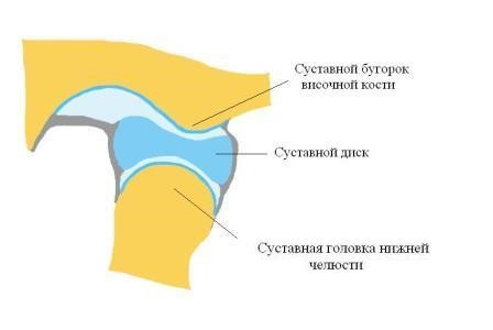 Остеоартроз височно-нижнечелюстного сустава: лечение ВНЧС