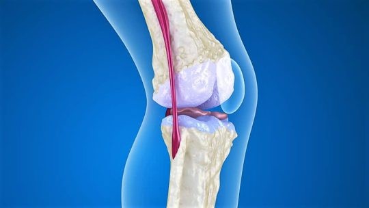 Остеопороз коленного сустава: симптомы и лечение колена