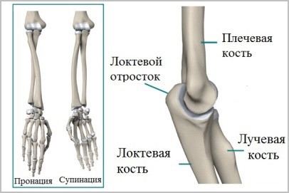 Причины, признаки и лечение перелома костей предплечья