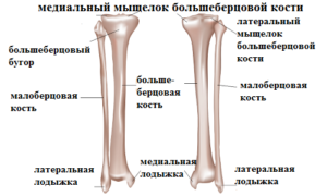 Типы переломов большеберцовой кости, и методы их лечения