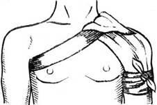 Колосовидная (косыночная) повязка на плечевой сустав: как наложить на плечо