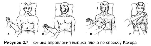 Симптомы и методы лечения привычного вывиха плеча