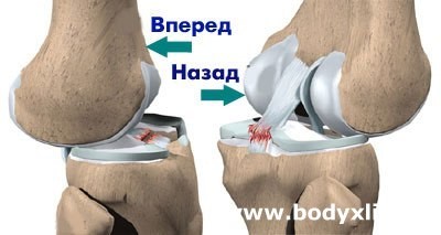 Частичный разрыв связок коленного сустава сколько заживает
