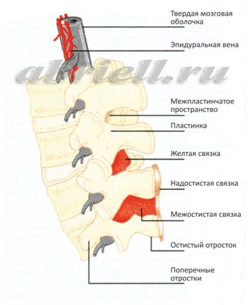 Боль в спине после эпидуральной анестезии