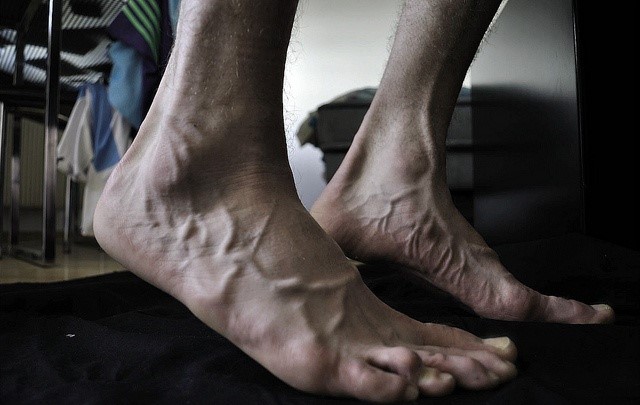 Ночные судороги ног в пожилом возрасте