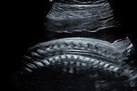 Обзор ультразвуковых диагностических приборов Sonomedica