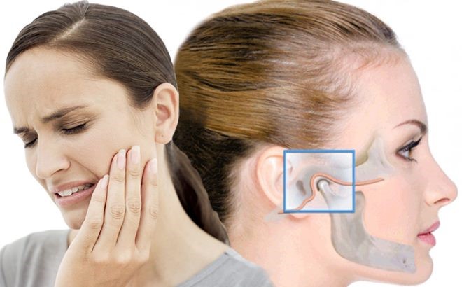 Вывих челюсти: Симптоматика и лечебная тактика